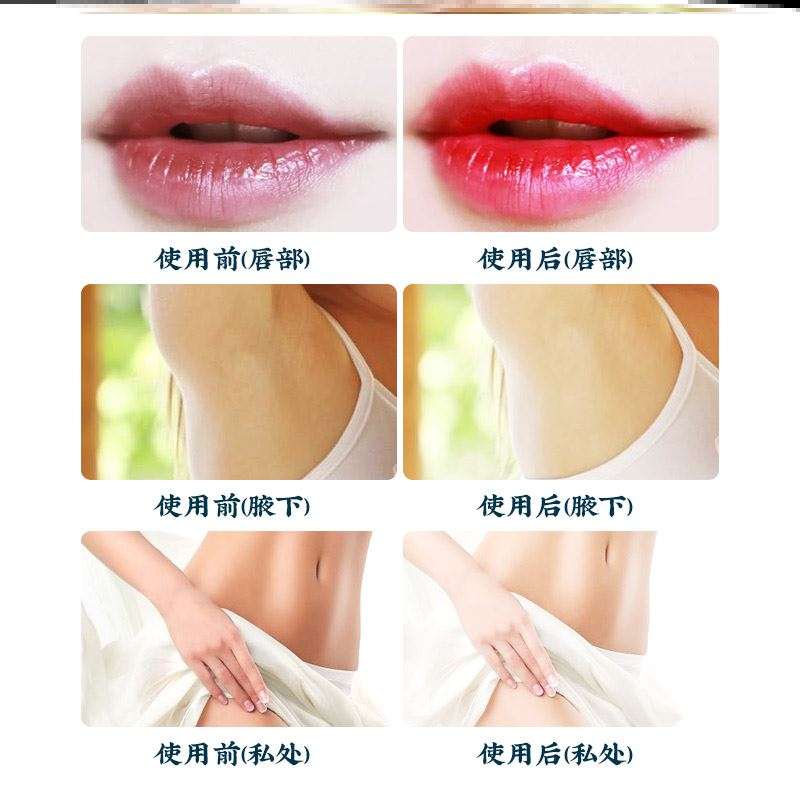 退黑素官方旗舰店腋下去黑美白黑色素沉淀去除脖子神器睡唇周黑
