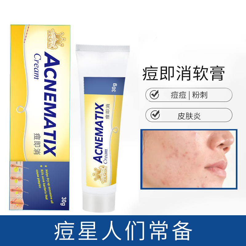 一号痘即消软膏去青春痘进口产品