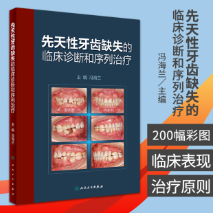 先天性牙齿缺失的临床诊断和序列治疗 先天性缺牙的分类 先天性缺牙的发病率 冯海兰编著 9787117311694 人民卫生出版社