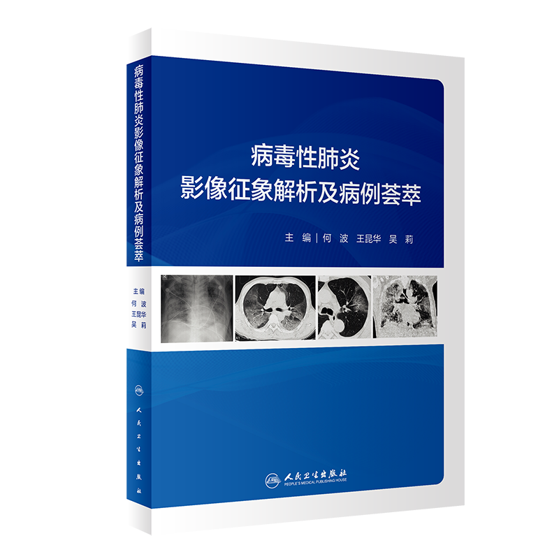 病毒性肺炎影像征象解析及病例荟萃 图文并茂 提高对本疾病的影像认识 何波 昆华 吴莉主编 9787117308762 人
