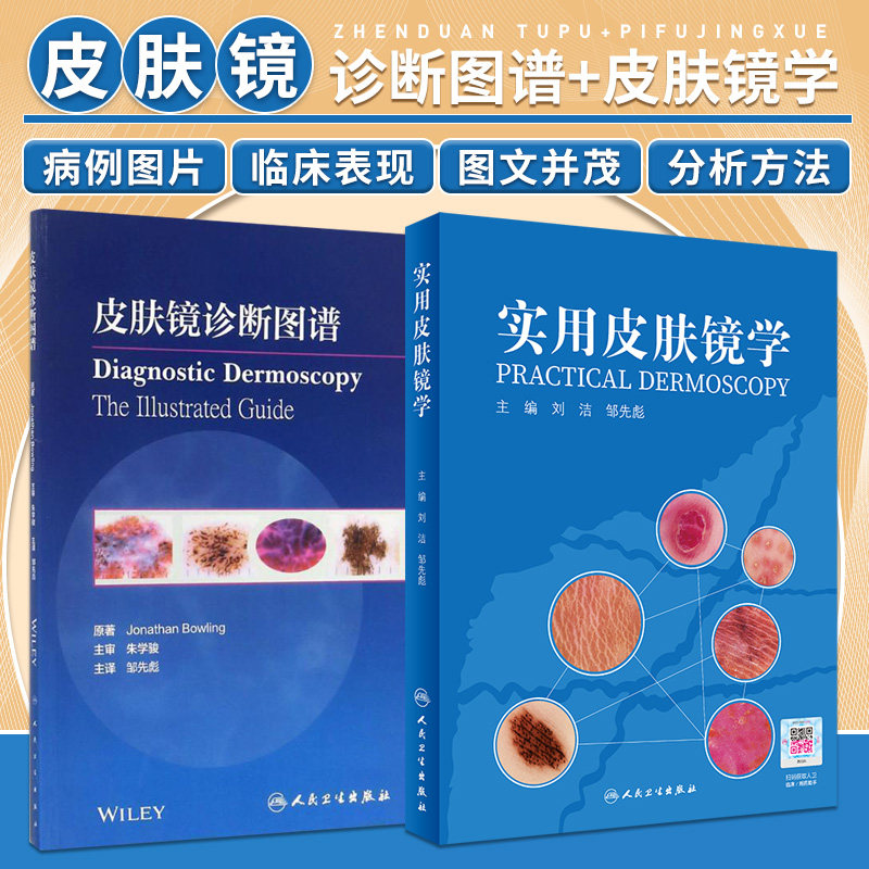 皮肤病诊断图谱+实用皮肤镜学 两本套装 皮肤病学与性病学 内容涵盖了皮肤镜的历史 皮肤肿瘤诊断方法 医学临床 皮肤病学 图文并茂