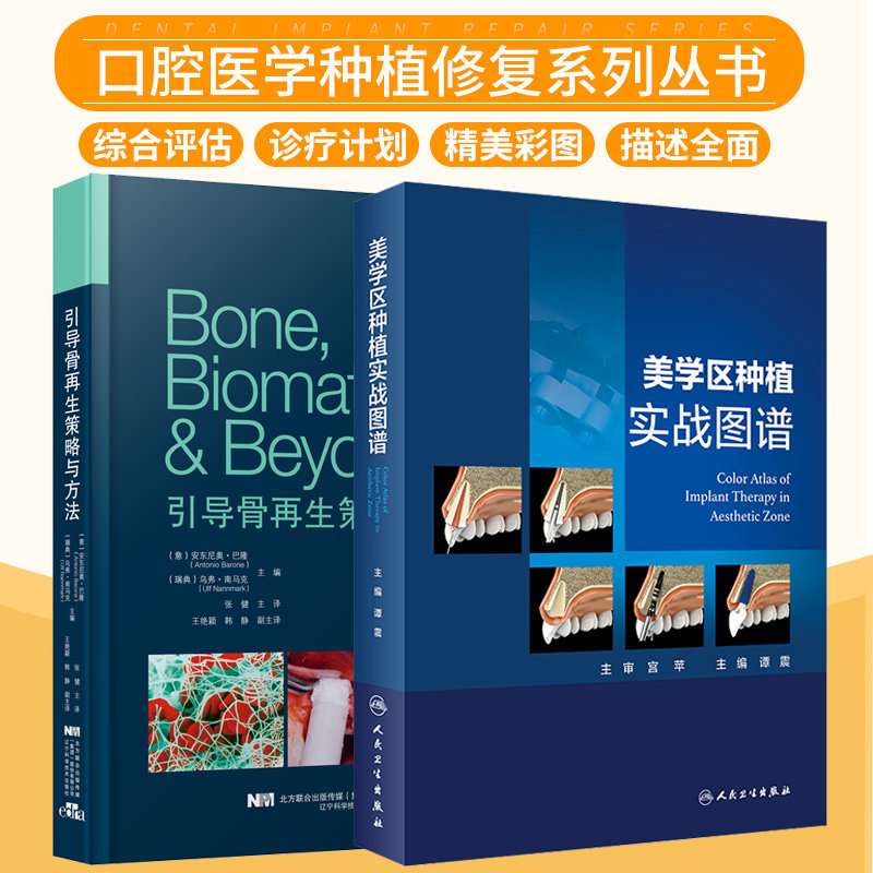 引导骨再生策略与方法+美学区种植实战图谱 两本套装 口腔种植学口腔修复种植领域美学专题牙槽峭水平向缺损重建的治疗方案