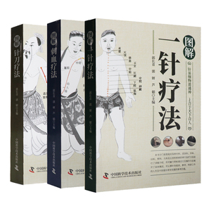 新版图解刺血疗法+图解一针疗法+图解针刀疗法 3本套装 郭长青 针虽细物道神通 通晓刺血疗法的起源及发展 中国科学技术出版社