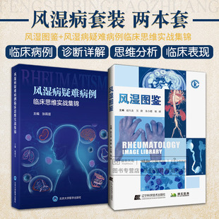 风湿图鉴+风湿病疑难病例临床思维实战集锦 2本套装 类风湿 关节炎 系统性红斑狼疮干燥综合征系统性硬化症多发性肌炎等