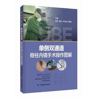许天明 潘浩 孙璟川UBE技术适应禁忌证体位麻醉手术入路步骤及并发症处理预防脊柱外科医生 张伟 单侧双通道脊柱内镜手术操作图解