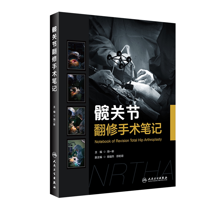 髋关节翻修手术笔记 种类型人工髋关节失败模式及手术处理方式 文字及配图精炼 包含30余例宝贵的病例 周一新 主编 人民卫生出版社