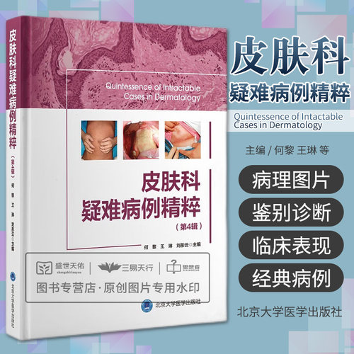 皮肤科疑难病例精粹 第4四辑 皮肤病学性病学 描述每一类疾病的发病机制及共性问题 常见皮肤病的少见罕见表现 北京大学医学出版社
