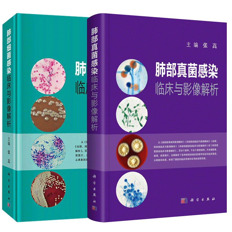 肺部细菌感染临床与影像解析+肺部真菌感染临床与影像解析 套装两本 张嵩主编 科学出版社 影像医学参考书 肺部影像诊断和鉴别诊断