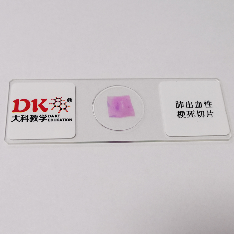 高等院校 病理组织学类 肺出血性梗死切片  生物玻片教学使用