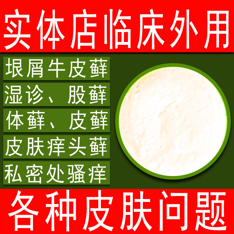 皮藓膏护肤止痒膏头皮肤身体痒