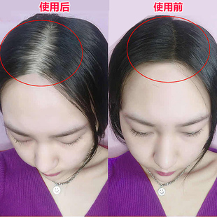 13天头发猛增 掉发越多效果越好 拯救脱发者还你满头乌黑秀发2发3