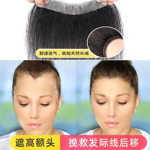 女前额发际线贴片真人发丝可染色