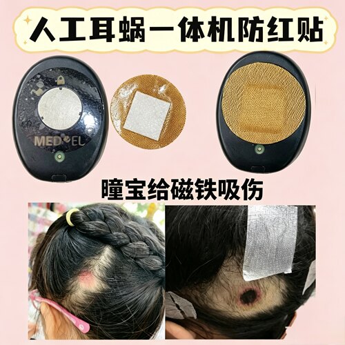 人工耳蜗一体机防汗防红贴RONDO1 RONDO2 RONDO3