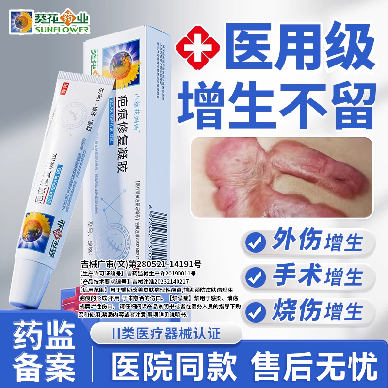 葵花药业祛疤凝胶告别增生凸起