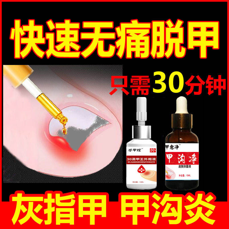 甲沟炎灰指甲快速脱甲液神器软甲膏嵌甲膏扎肉增厚消红肿止痛