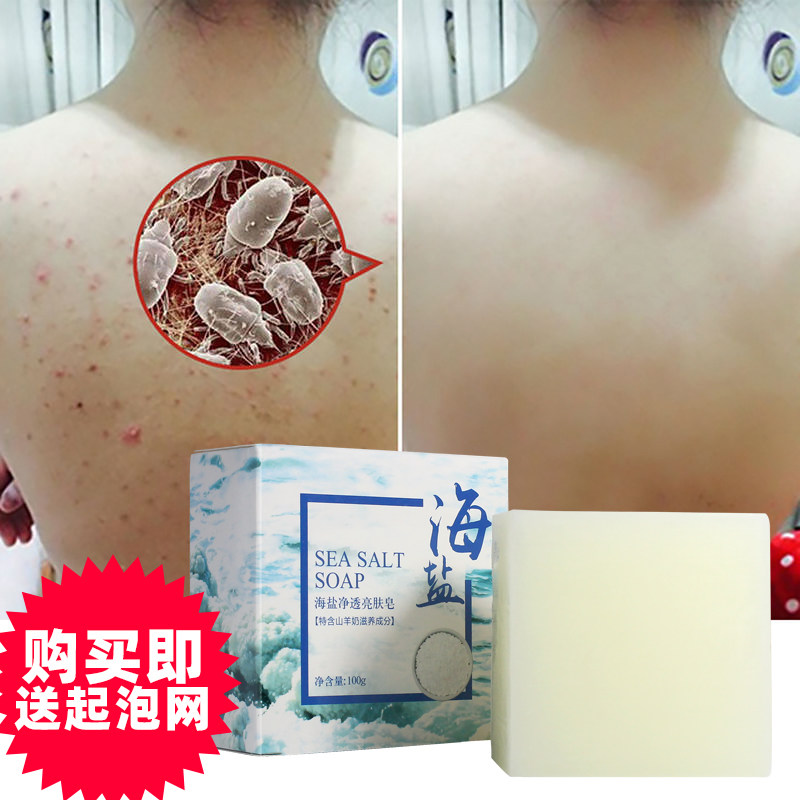 清洁毛孔控油洗脸澡皂去痘除螨虫海盐香皂提亮面部男女后背止痒皂,洗护清洁剂/卫生巾/纸/香薰,香皂,淘宝优惠券,粉丝福利购,淘宝优惠卷