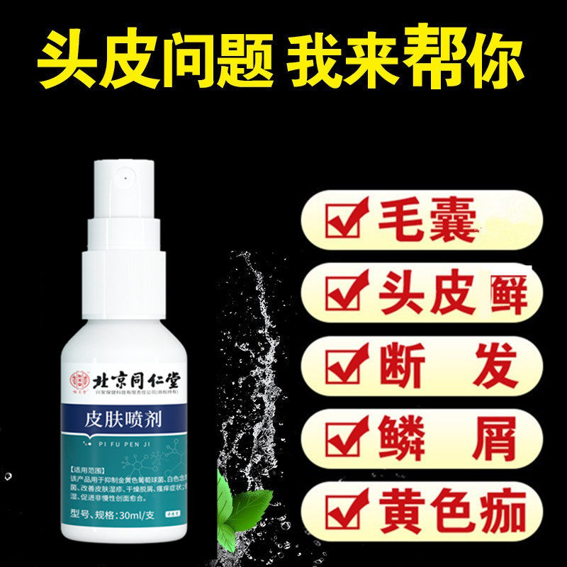 头皮毛囊喷雾头癣藓长专用药头发有痒去洗发水抗真菌止痒头皮屑炎