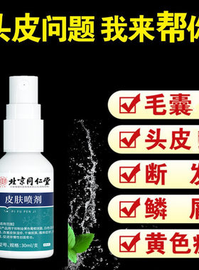 头皮毛囊炎头屑掉用喷雾