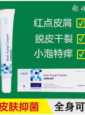 皮肤真菌痒藓康抑菌霜乳膏谱语