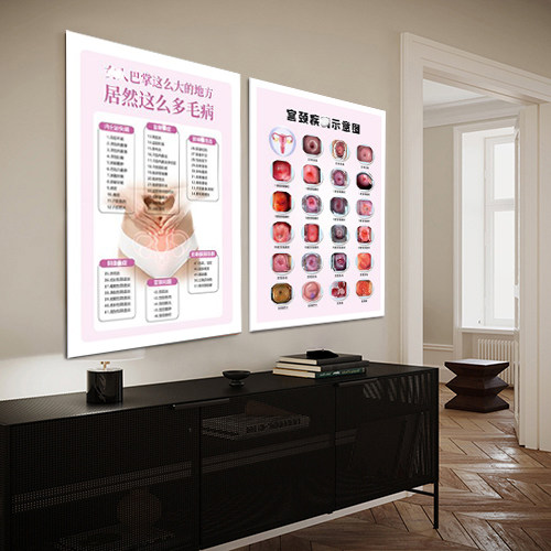 宫颈疾病预防检测挂画 女性生殖健康私密保养装饰画妇科医院墙画