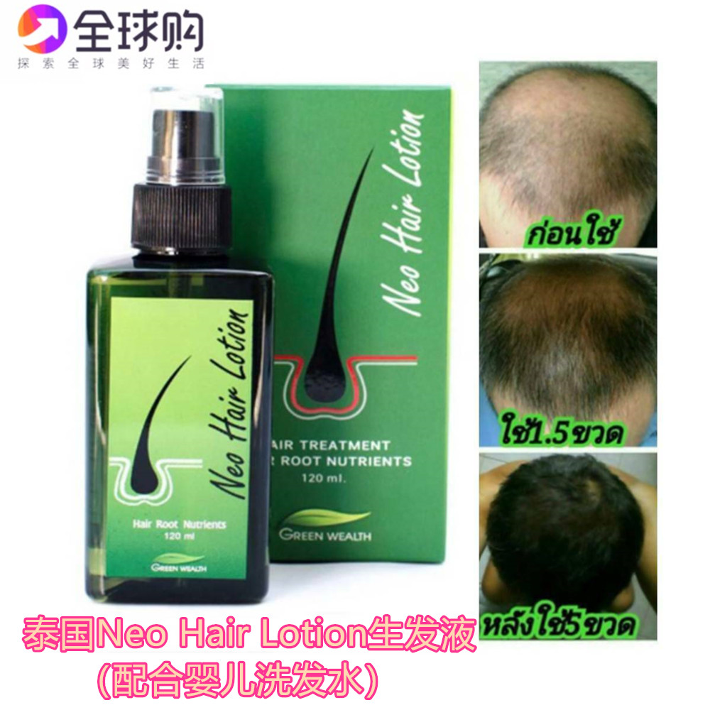 泰国生发液Ne0 Hair 控油防脱浓密重生产后脱发发际线拯救Atreus