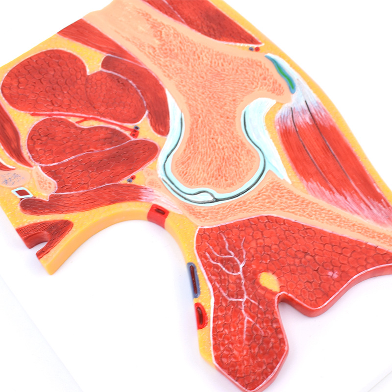 ENOVO颐诺医学解剖髋关节骨骼肌肉模型髋关节剖面髋关节构造MRI
