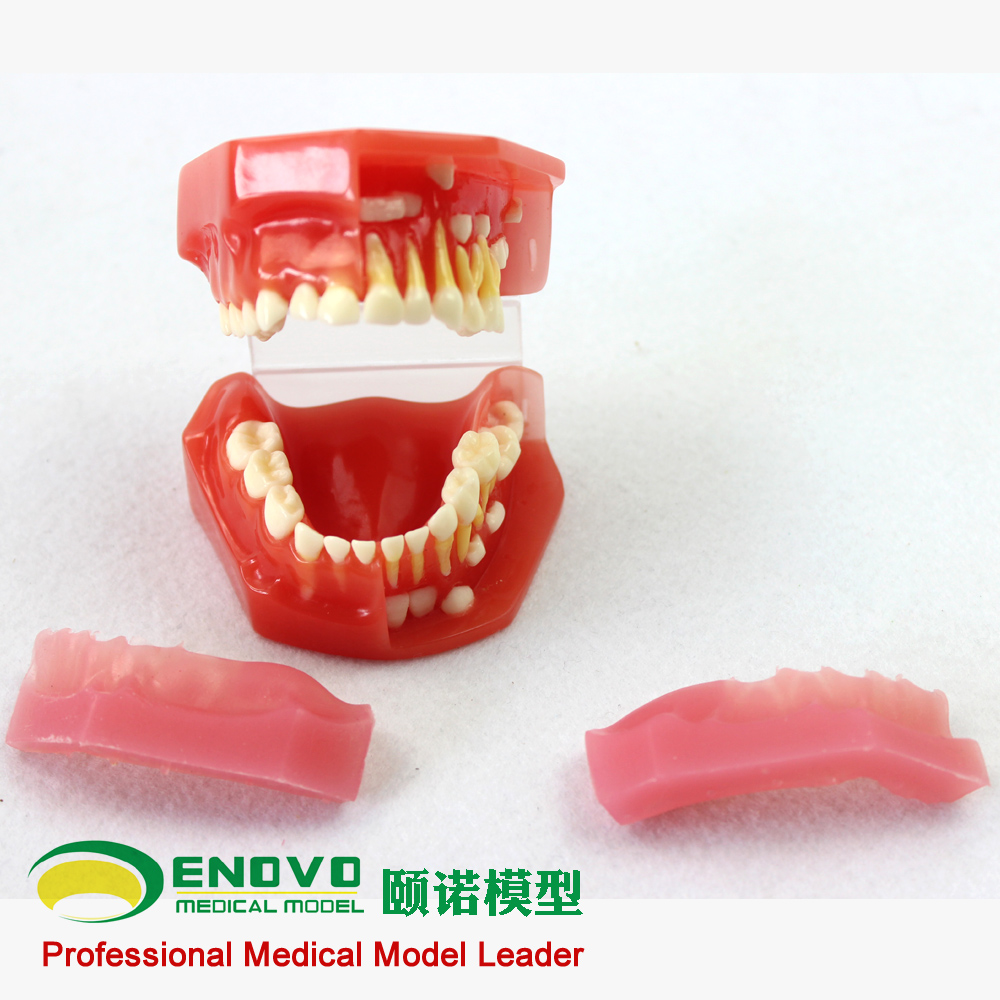 ENOVO颐诺儿童乳牙发育牙列模型儿童口腔教学医生培训牙科齿科