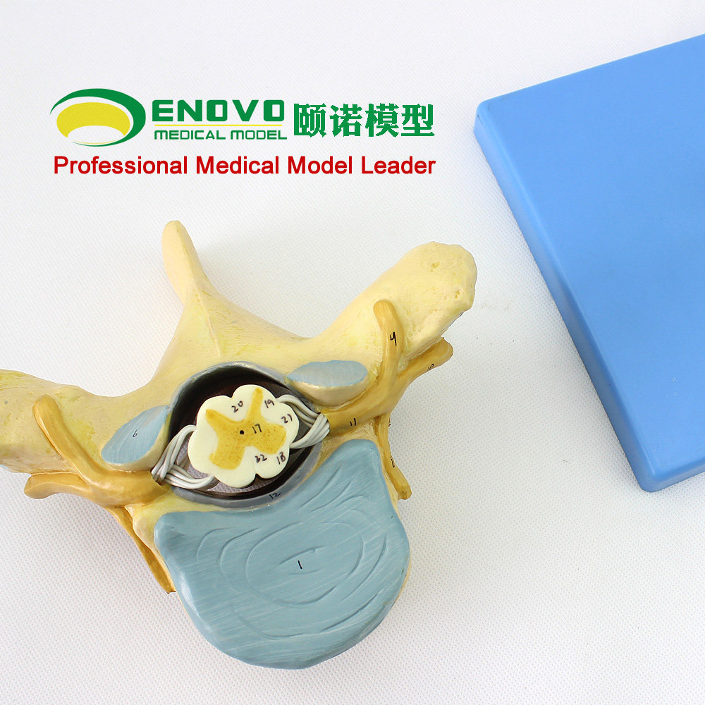 enovo颐诺医学人体胸椎附脊髓和脊神经放大模型神经骨科解剖模型