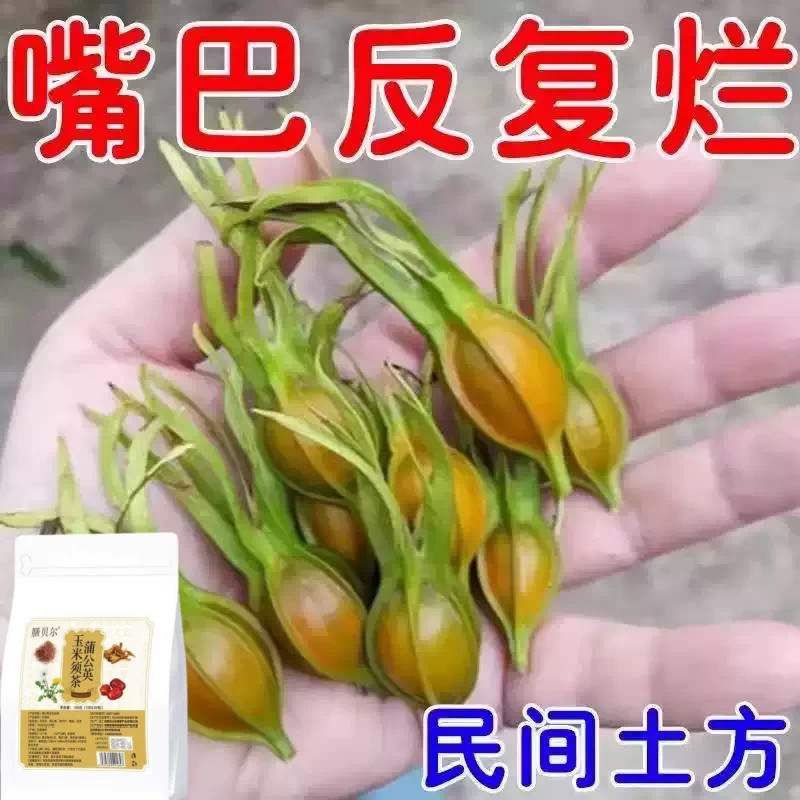 口腔溃疡口舌生疮牙龈肿痛上火起泡嘴唇溃烂正品泡水口腔溃疡茶