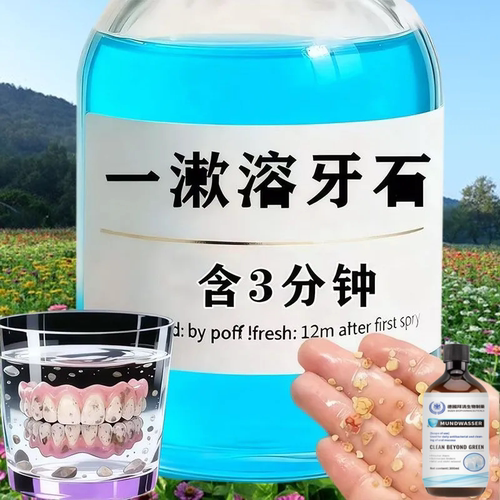 【重度牙结石】牙石溶解漱口水洗牙齿污垢牙垢牙黄牙渍清理通用