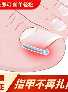 甲沟矫正器嵌甲指甲往肉里长专用隔离填充垫片脚趾炎甲沟矫正神器