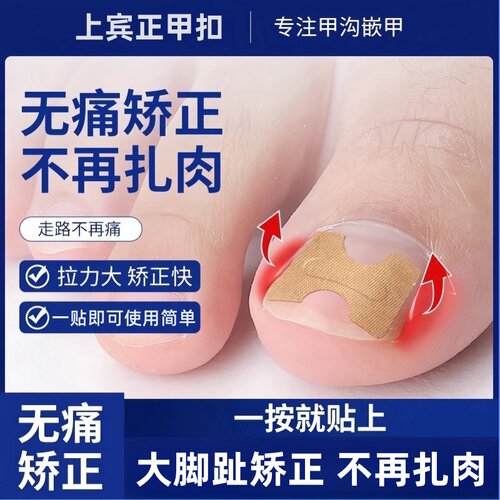 甲沟炎矫正贴片免胶水
