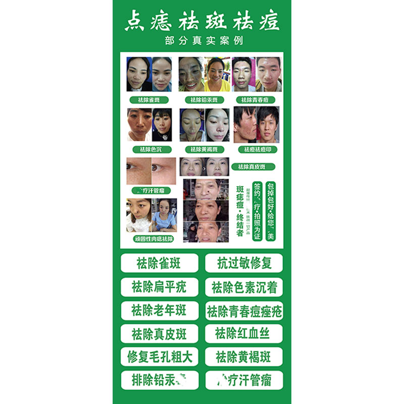 专业祛斑祛痘广告点痣海报宣传画对比图中药门型展架祛斑广告图片