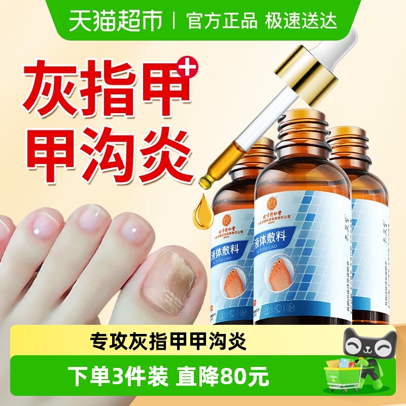 北京同仁堂灰指甲甲沟炎专用