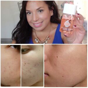 [法国小儿郎代购身体按摩]法国正品Bi-oil百洛万能生物油6月销量0件仅售129.99元