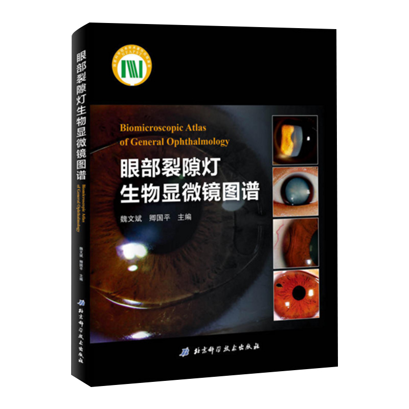 正版 眼部裂隙灯生物显微镜图谱 眼科多发病的治疗与鉴别诊断技术书籍 眼科学临床医学疾病在裂隙灯检查中的要点 9787530488607
