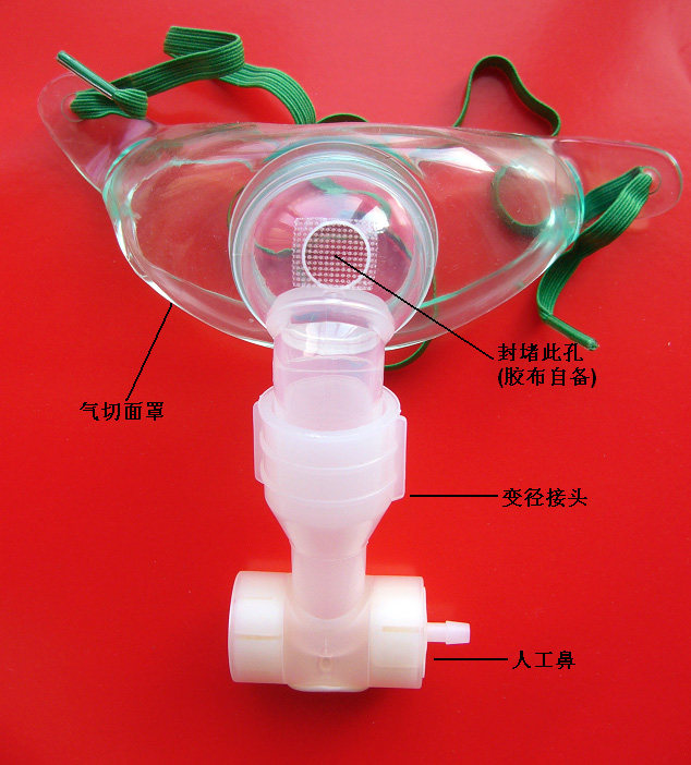 金属套管气管切开患者气切人工鼻