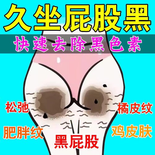 屁股去黑痘印坐印修复淡化美白霜