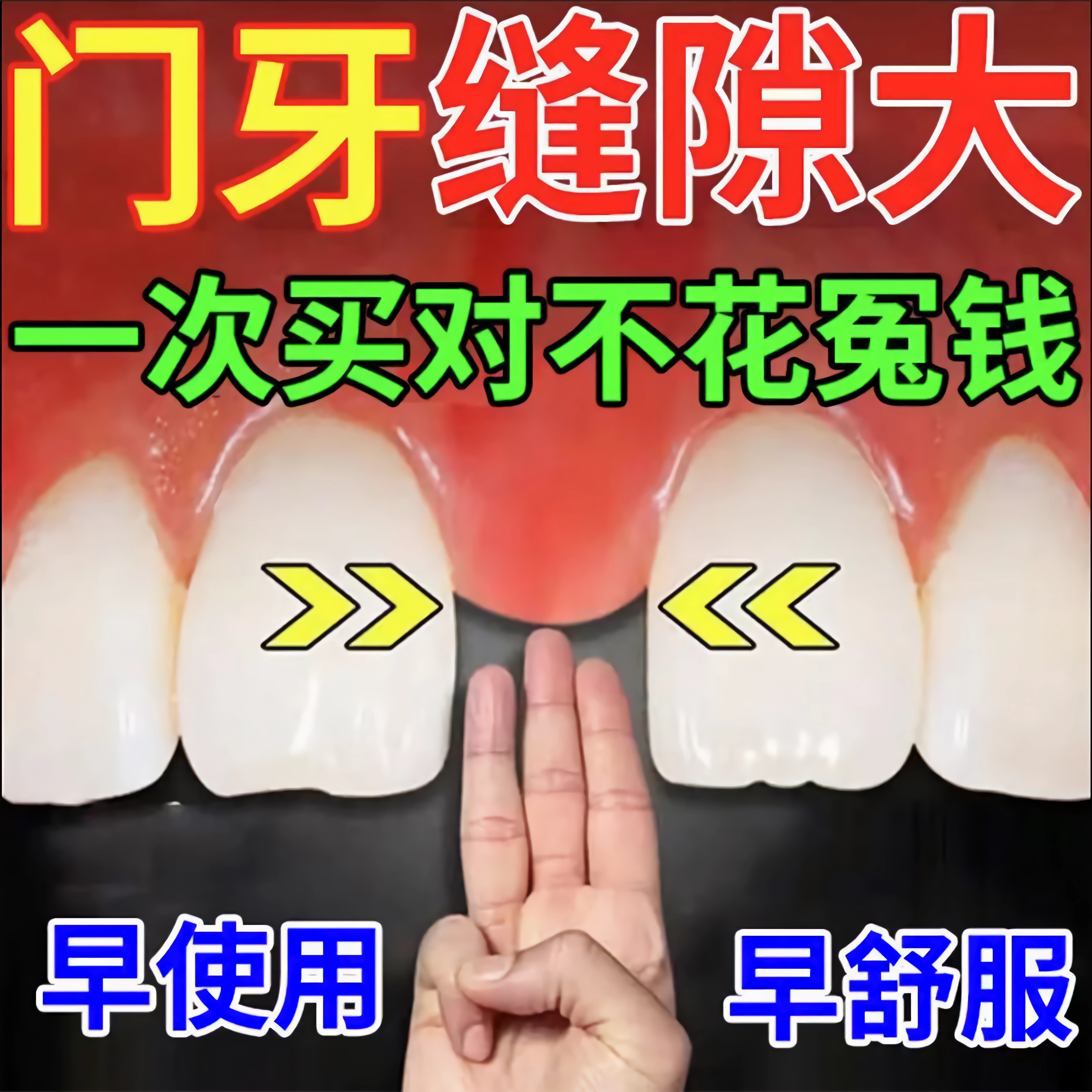 补门牙缝贴片牙缝大修复牙齿