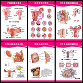 女性生殖器解剖图 妇科知识糜烂宫颈疾病示意图 医院宣传海报挂图