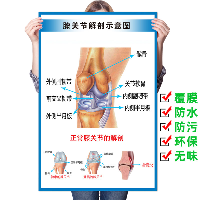 医学关节解剖图壁画膝关节解剖挂图髋手脚骨科宣传示意图健康海报