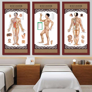 中医养生人体经络穴位图病症图解挂图装饰画按摩针灸艾灸拔罐海报