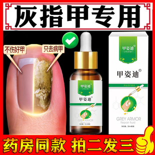 甲姿迪灰指甲治疗专用正品旗舰店凤仙花抑菌液修复指甲亮甲空甲