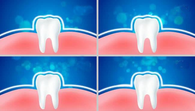 美白健康口腔4k视频素材牙科整形洁牙洗牙超清视频牙白修复动画