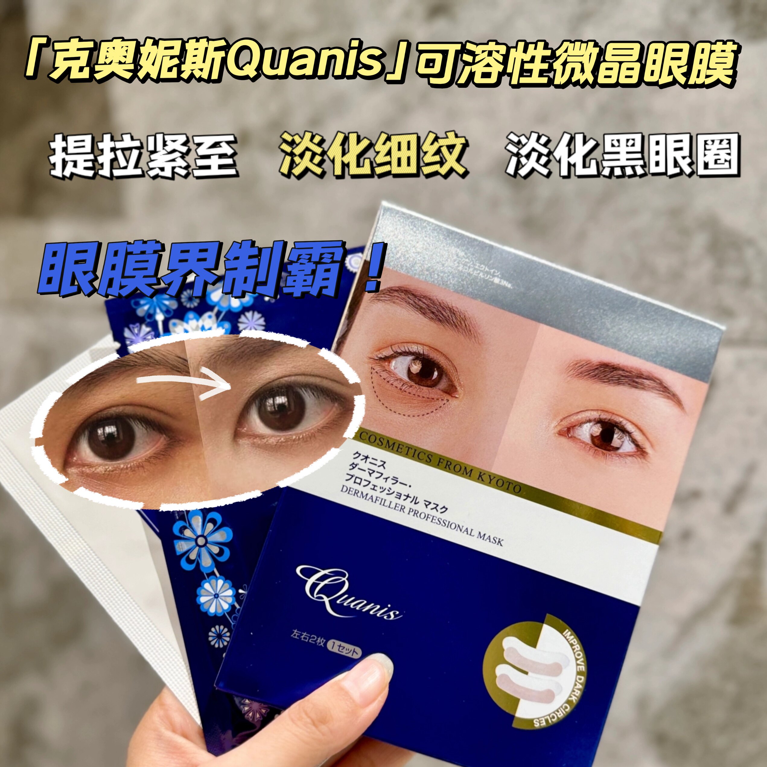 1000针克奥妮斯quanis玻尿酸微针眼膜泪沟纹法令纹克奥尼斯