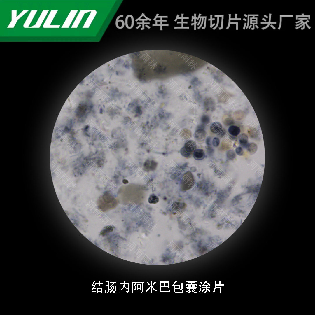结肠内阿米巴包囊涂片生物标本切片动植物细胞载玻片观察实验高校