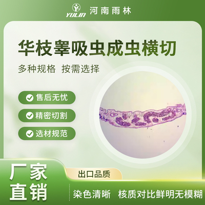 华枝睾吸虫囊蚴装片肝吸虫切片