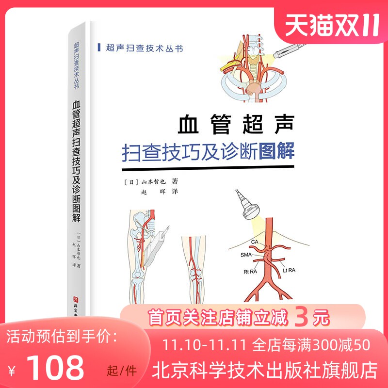 血管超声扫查技巧及诊断图解 日本持续畅销 超声扫查技术丛书 血管解剖—扫查方法—诊断要点 一看就明白准确操作 抓住诀窍怎么样,好用不?