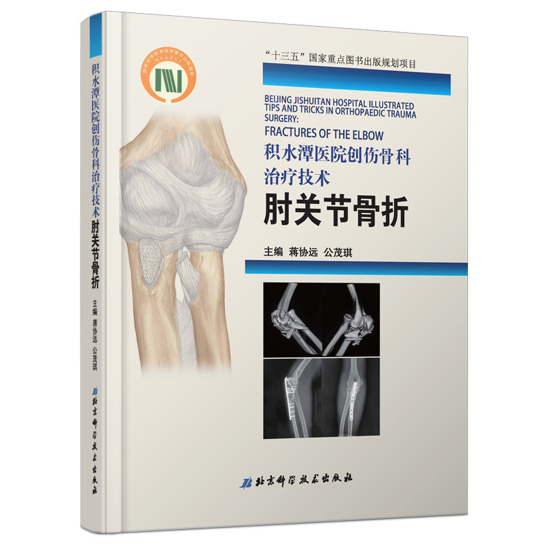 【包邮】积水潭医院创伤骨科治疗技术. 肘关节骨折（积水潭骨折治疗系列第3册）