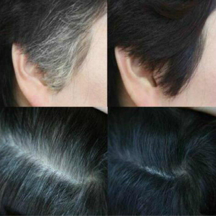 日本refine遮盖白发膏神器一次性发际线染发剂笔棒粉饼美发无刺激